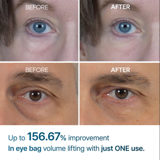 Dr Melaxin Anti-Wrinkle Eye Cream Stick